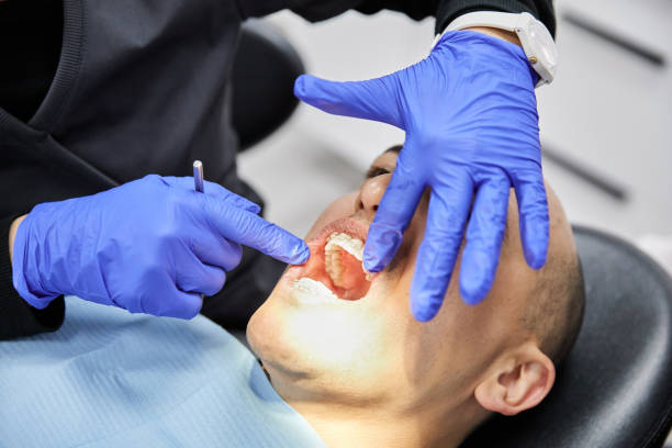 Best Emergency Dentist for Special Needs Patients in Palm Desert, CA